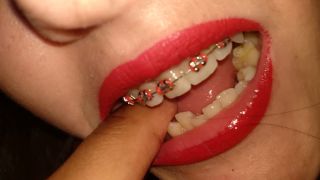 6228 Alyssa Quinn - Teen Girl With Braces & Flowers Does    -7