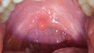 Uvula Compilation: Mouth Fetish 1080p-2