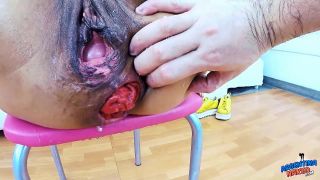 free video 14 Anna in Asshole Destruction – She Squirted like Hell! Punch Fisting both in Pussy and Asshole – AN-321 - anal - fisting porn videos ryan conner fisting-8