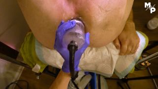Anal Fisting & Vacuum Pump Fun: Marcus Pollack's 2025 FullHD Femdom-8