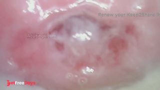 Creamy Cervix-1