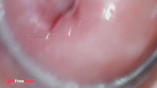 Creamy Cervix-5