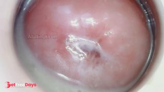 Creamy Cervix-7