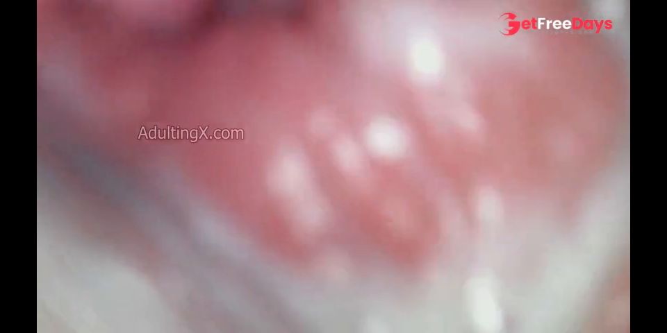 Creamy Cervix