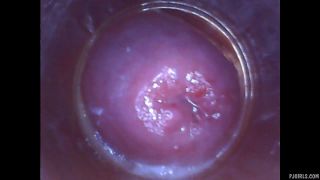 free porn clip 10 RAW endoscopic video | fetish | femdom porn amateur fetish porn-9