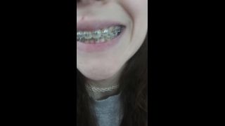 adult video clip 23 Braces tour | mouth fetish | fetish porn male feet fetish-8