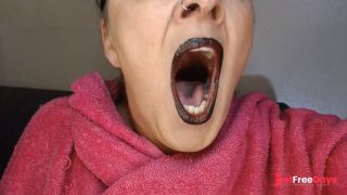 Anna Yawning Over and Over Big Wide Open Mouth Teary Eyed Tired-5