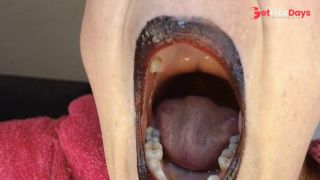 Anna Yawning Over and Over Big Wide Open Mouth Teary Eyed Tired-9