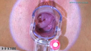  Naomi   Close ups Close ups, Blondes, Enema, Medical Fetish, Toys, Shaved Pussy Naomi. 21 years girl gyno exam SiteRip-7