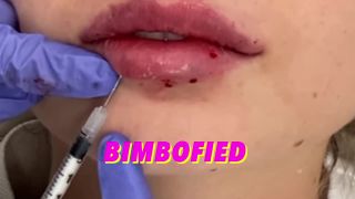 free adult clip 13  Kimber Haven - Turn Betas Into Bimbos Part1 Lip Augmentation [HD 720p], shemale passive on shemale porn-2