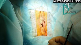 Metadoll.to - Gynecological medical films 45-4