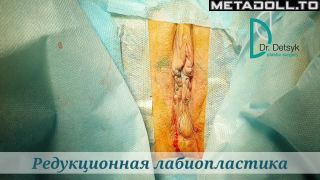 Metadoll.to - Gynecological medical films 45-9