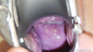 porn clip 11 hardcore fetish hardcore porn | Old Pussy Exam - Liba | fetish-2