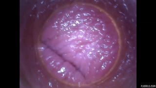 RAW endoscopic video-3