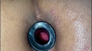 free video 42 fisuras anales y hemorroides big ass porn | Dilator Ass JOI | fetish-0