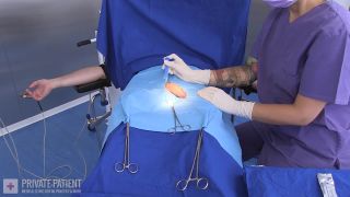 porn clip 1 hairy hardcore hd private-patient - Circumcision 06 [FullHD 1080p], hardcore on hardcore porn-3
