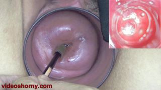 7155 Fisting, Anal fingering, pussy Stretching, Gaping 13-7