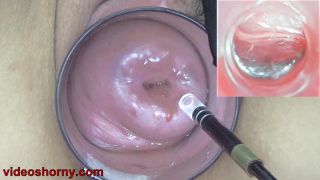 7155 Fisting, Anal fingering, pussy Stretching, Gaping 13-8