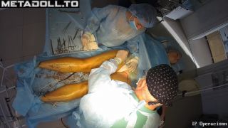 Metadoll.to - Gynecology operation 64-6