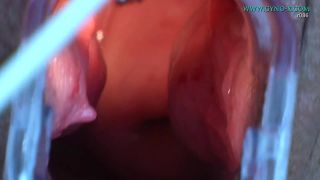 ClinicFetishMedicalVideo00451-3