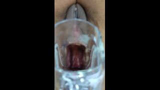 M@nyV1ds - XAMY_97 - nice view of a speculum in my big ass-4