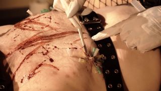 online xxx clip 20 Needles and scalpel II on fetish porn asian femdom-0