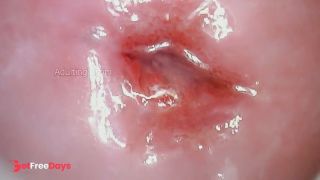 Throbbing Wet Cervix-0