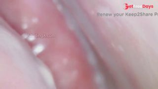 Throbbing Wet Cervix-1
