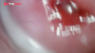 Throbbing Wet Cervix-3