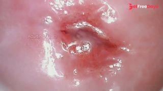 Throbbing Wet Cervix-5