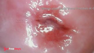Throbbing Wet Cervix-6