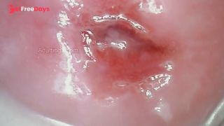 Throbbing Wet Cervix-7