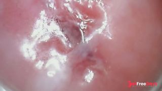 Throbbing Wet Cervix-9