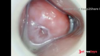 Horny Juicy Cervix-1