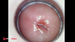Horny Juicy Cervix-2