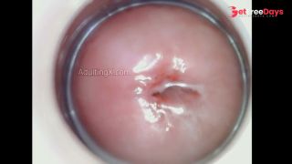 Horny Juicy Cervix-3