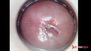 Horny Juicy Cervix-5