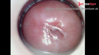 Horny Juicy Cervix-6