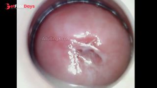 Horny Juicy Cervix-7