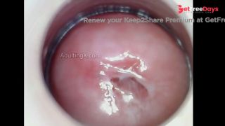 Horny Juicy Cervix-8