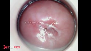 Horny Juicy Cervix-9