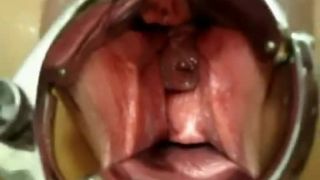 free video 4 Monster pussy stuffing on femdom porn literotica fisting-2